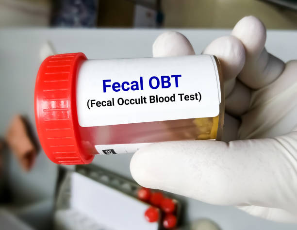 Mengenal Occult Bleeding, Pendarahan Tersembunyi yang Sering Tak Disadari
